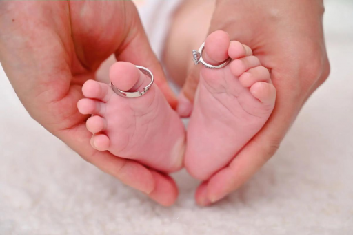 琼中孕妇肝内胆汁淤积症